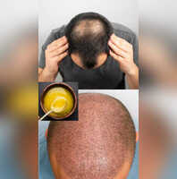 Desi ghee for hair Desi ghee for hair for regrowth, hair fall in hindi