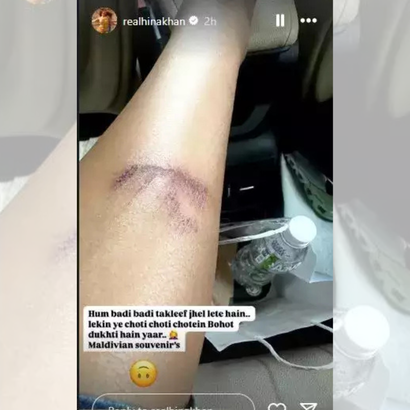 Hina Khan injured