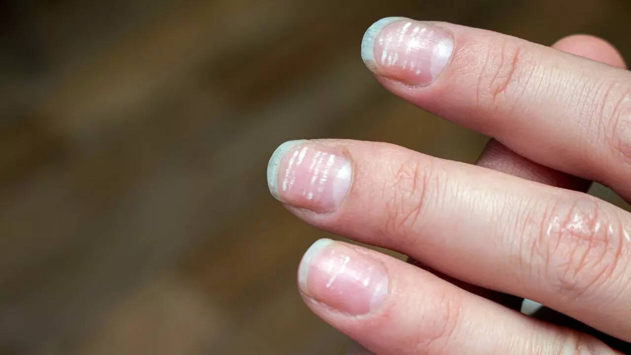 steps to take perfect care of your nails in winter in Hindi-सर्दियों में बार-बार नाखून टूटने की वजह से हो रहे हैं परेशान? अपनाएं ये घरेलू नुस्खे| Lifestyle News,Hindi News steps to take perfect care of your nails in winter in Hindi-सर्दियों में बार-बार नाखून टूटने की वजह से हो रहे हैं परेशान? अपनाएं ये घरेलू नुस्खे| Lifestyle News,Hindi News