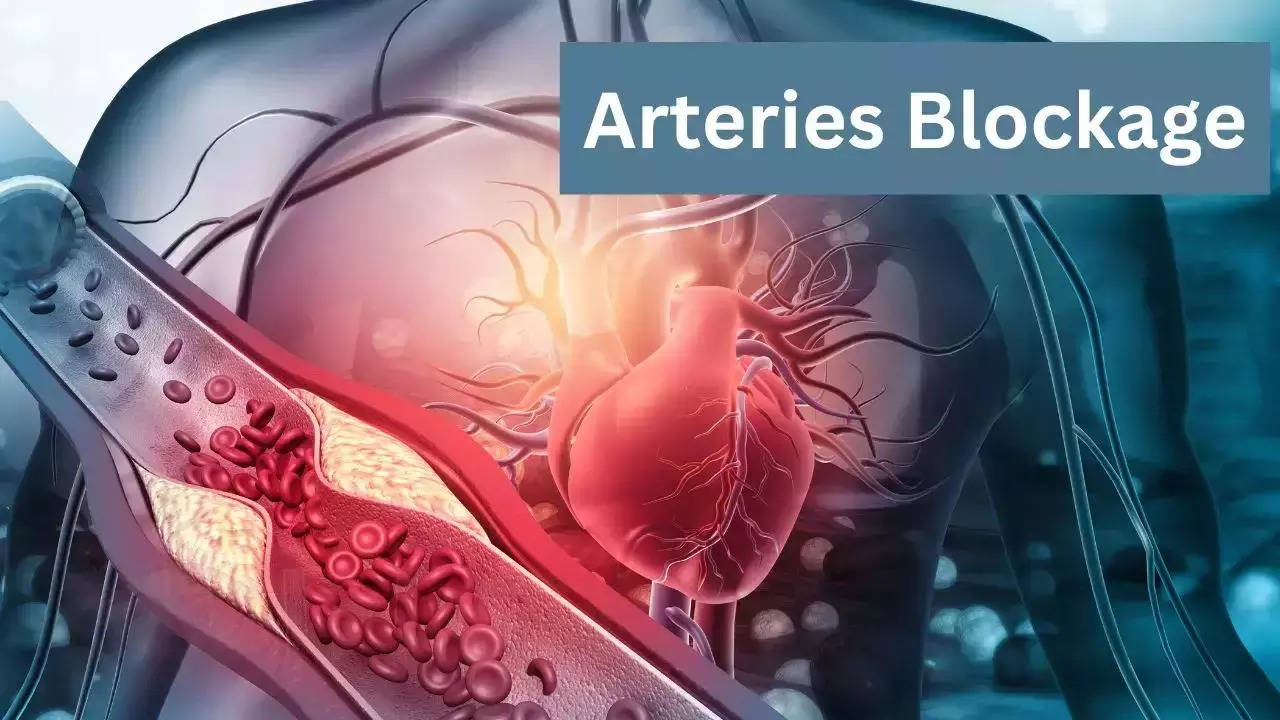 Arteries Blockage Problem