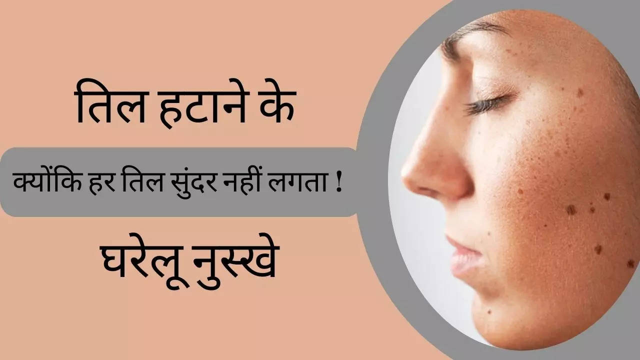 How To Remove Moles, Til hatane ke nuskhe, face par til