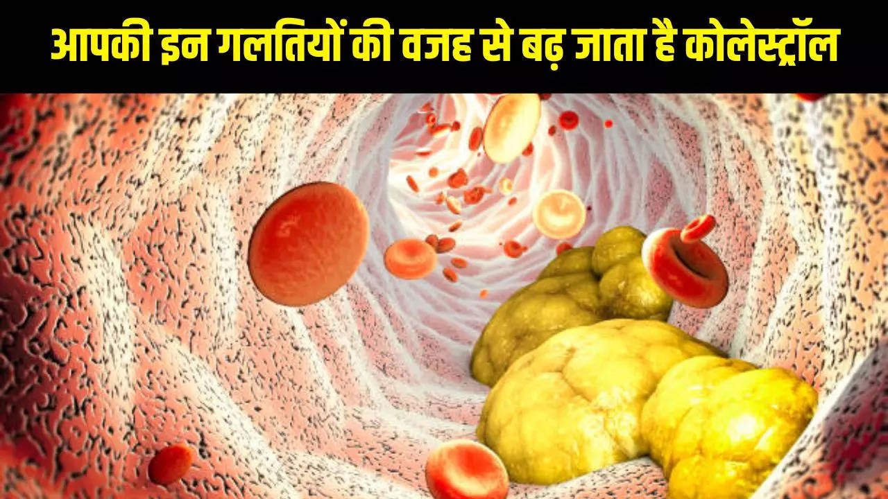 LDL Cholesterol, Cholesterol Food, Cholesterol Problem