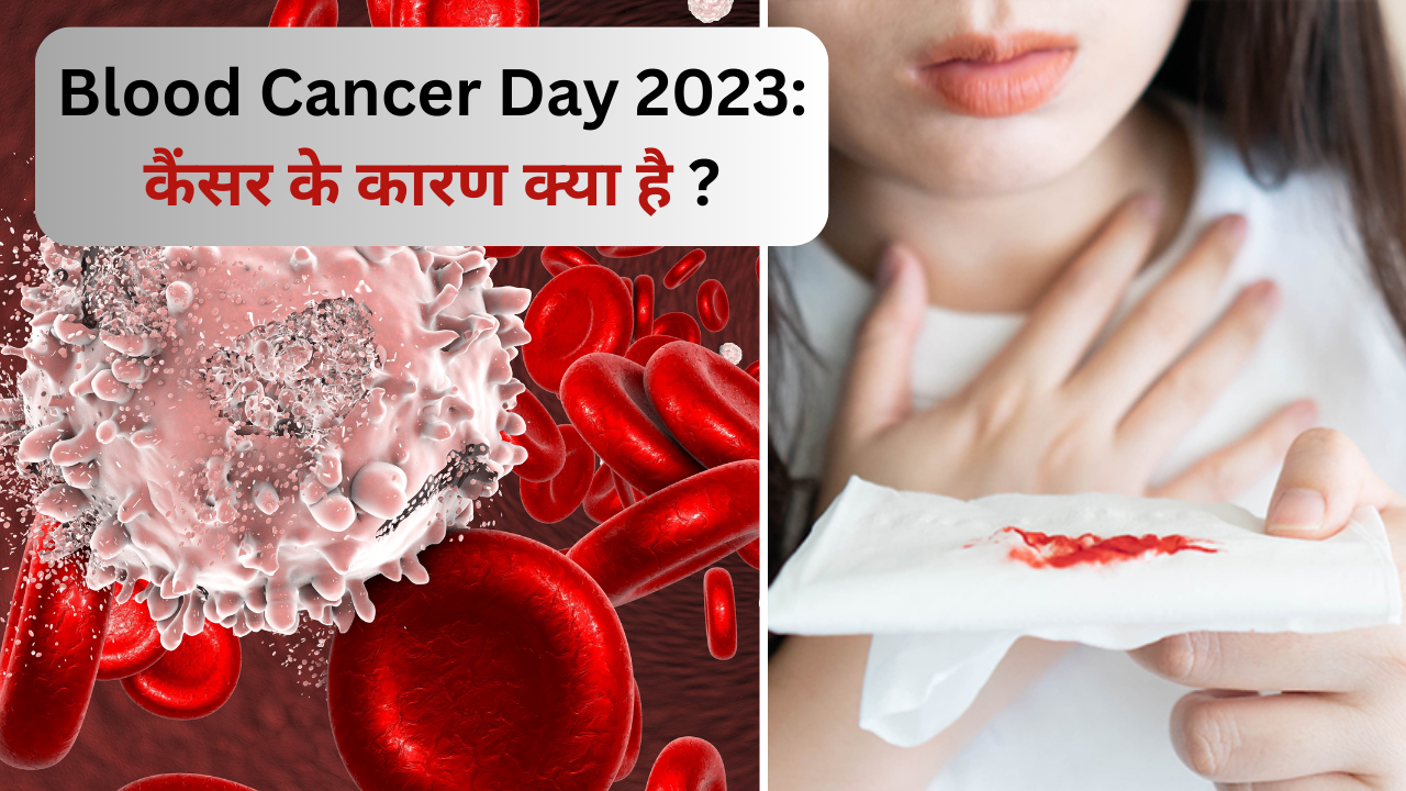 Blood cancer day 2023, causes of cancer, cancer treatment risk and remedies