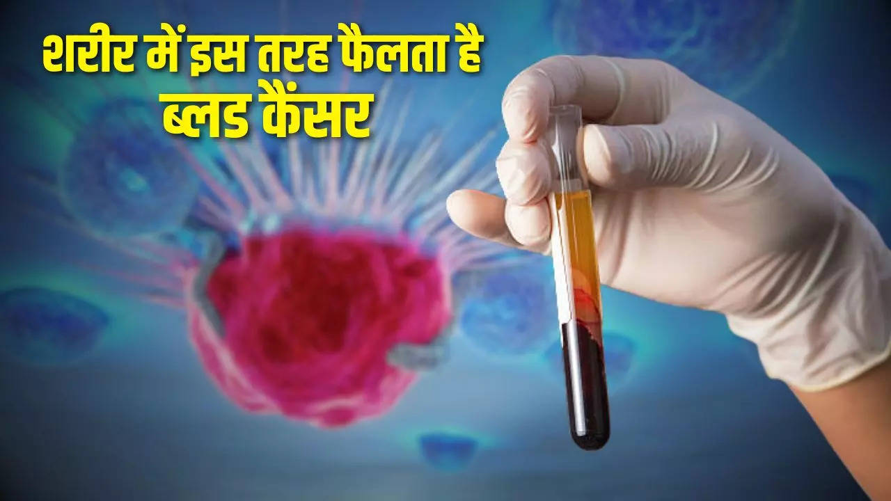 Blood Cancer, Cancer Treatment, Blood Cancer Symptoms