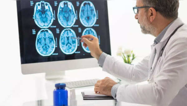 Migraine Pain, Brain Tumor, World Brain Tumor Day 2023 (1)
