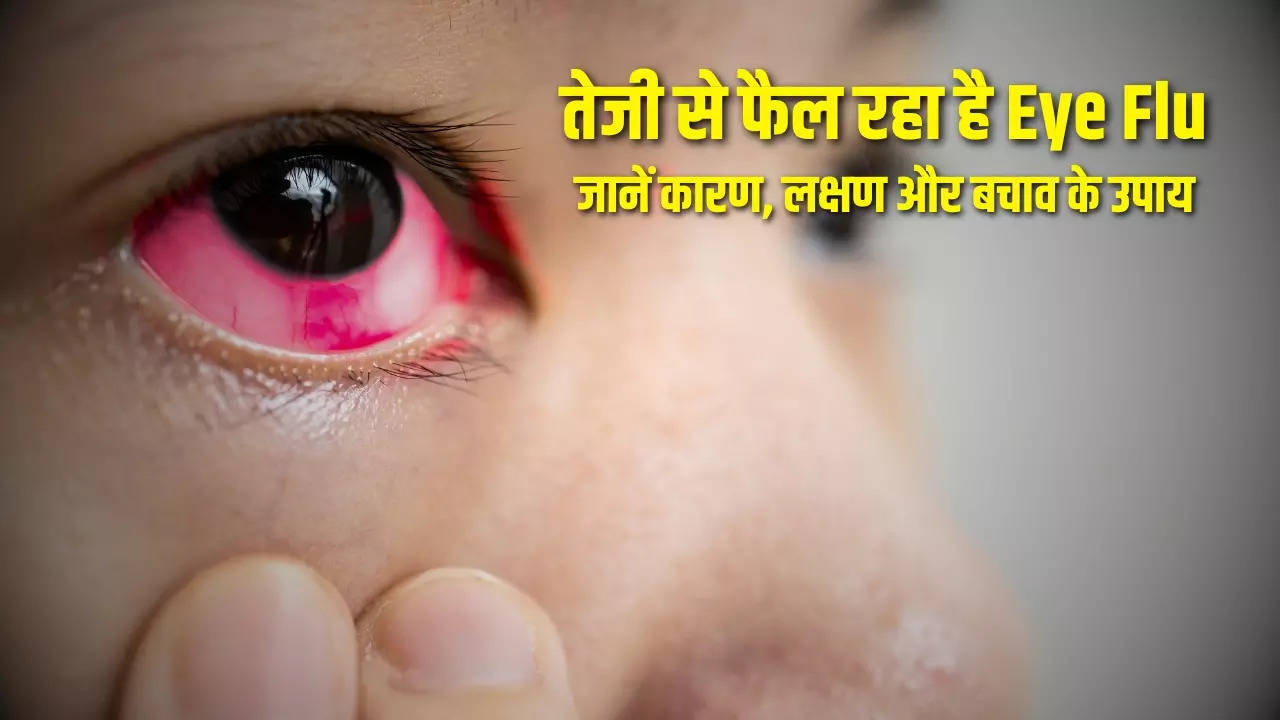 Eye Infection Causes, Eye Flu Infection symptoms