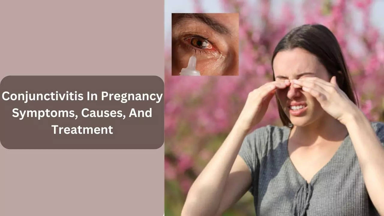 Conjunctivitis In Pregnancy Symptoms, Causes, And Treatment