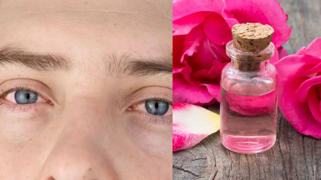 Rose Water, Eye Flu, Eye Flu Home Remedies