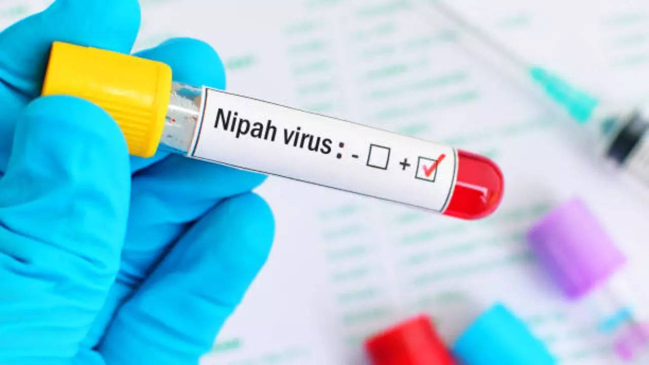 nipah virus