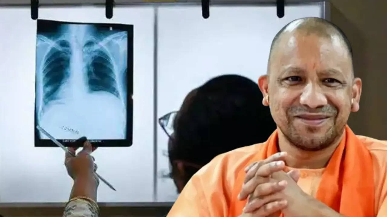 CM yogi Plan for Tuberculosis Patient Search Campaign 