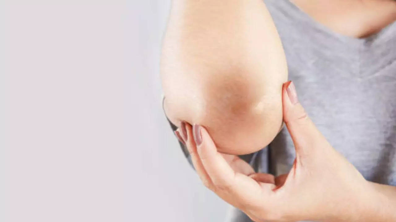 how to get rid of dark elbows