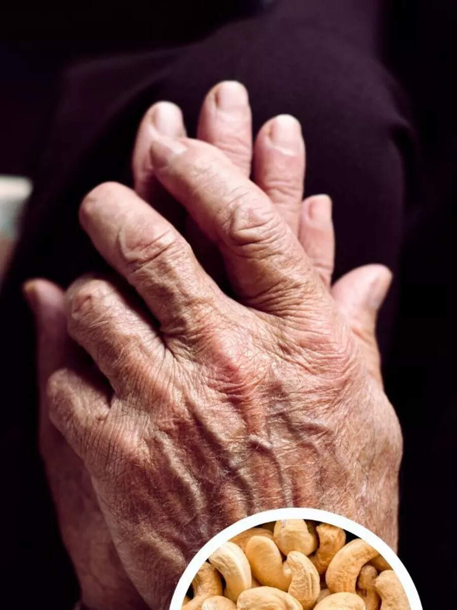 9 Health Benefits Of Cashew Dry Fruit Kaju Khane Ke Fayde जिंदगीभर