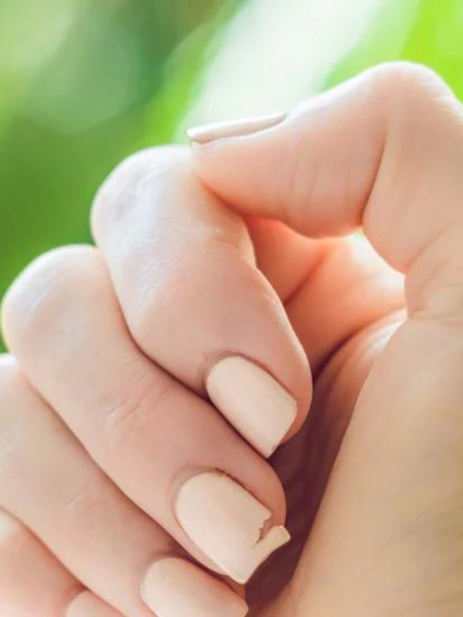सतत नखं तुटत असतील तर करा 5 सोपे उपाय 5 home remedies to get rid of