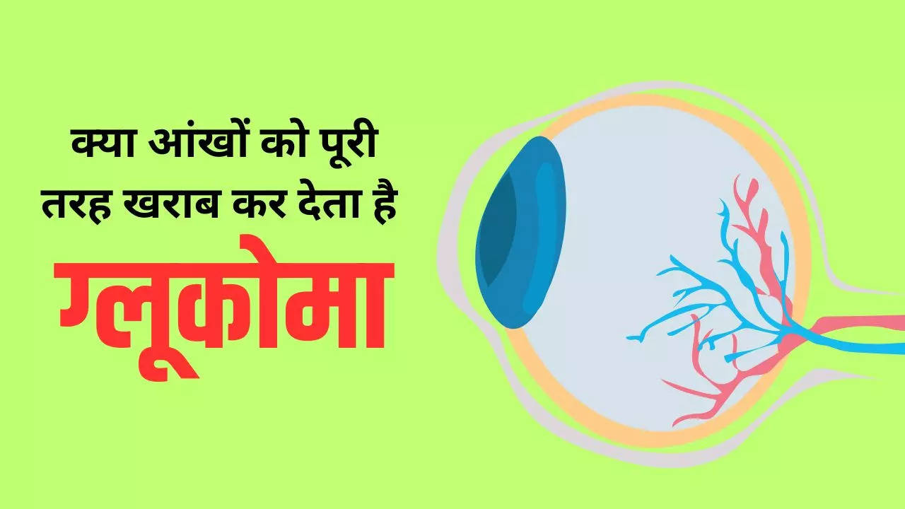 glucoma facts in hindi