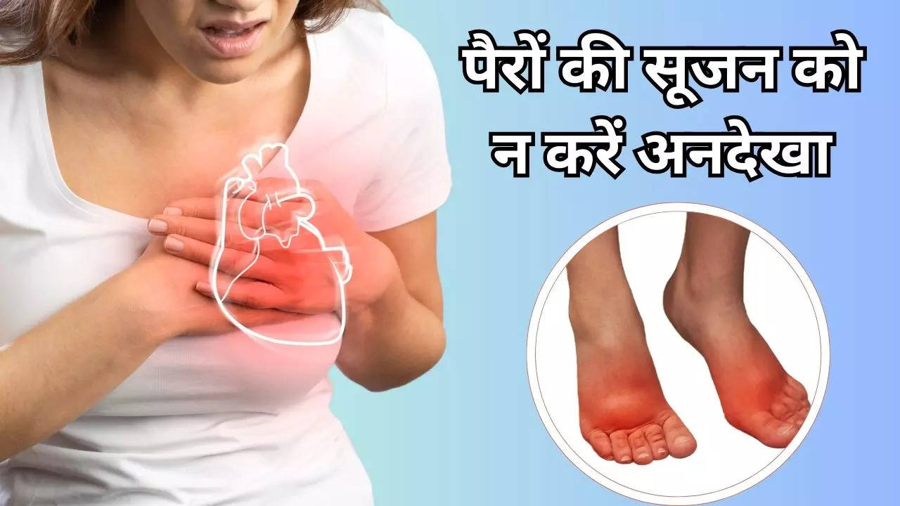 Swollen Feet Can Be Sign Of Heart Disease