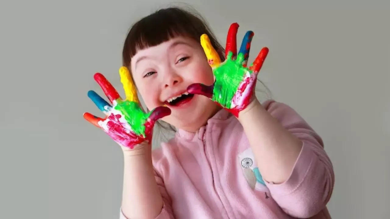 What Is Down Syndrome And Causes