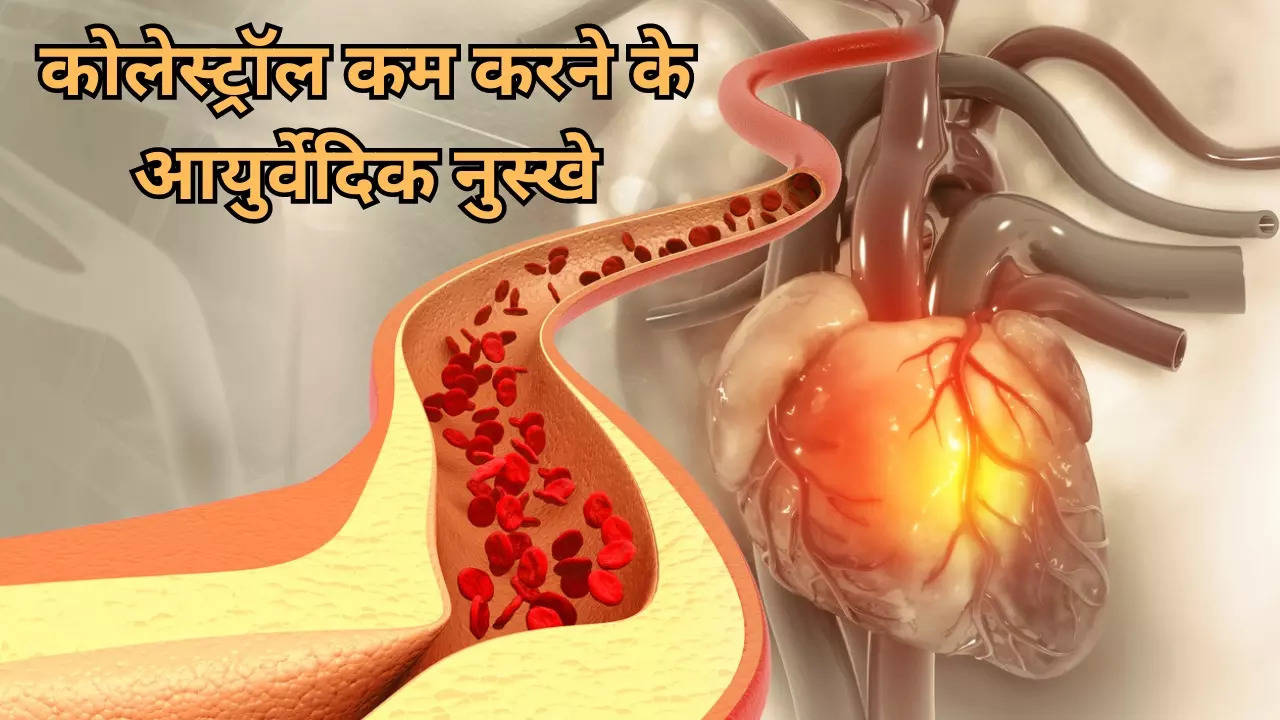 Ayurvedic Remedies To Lower Cholesterol