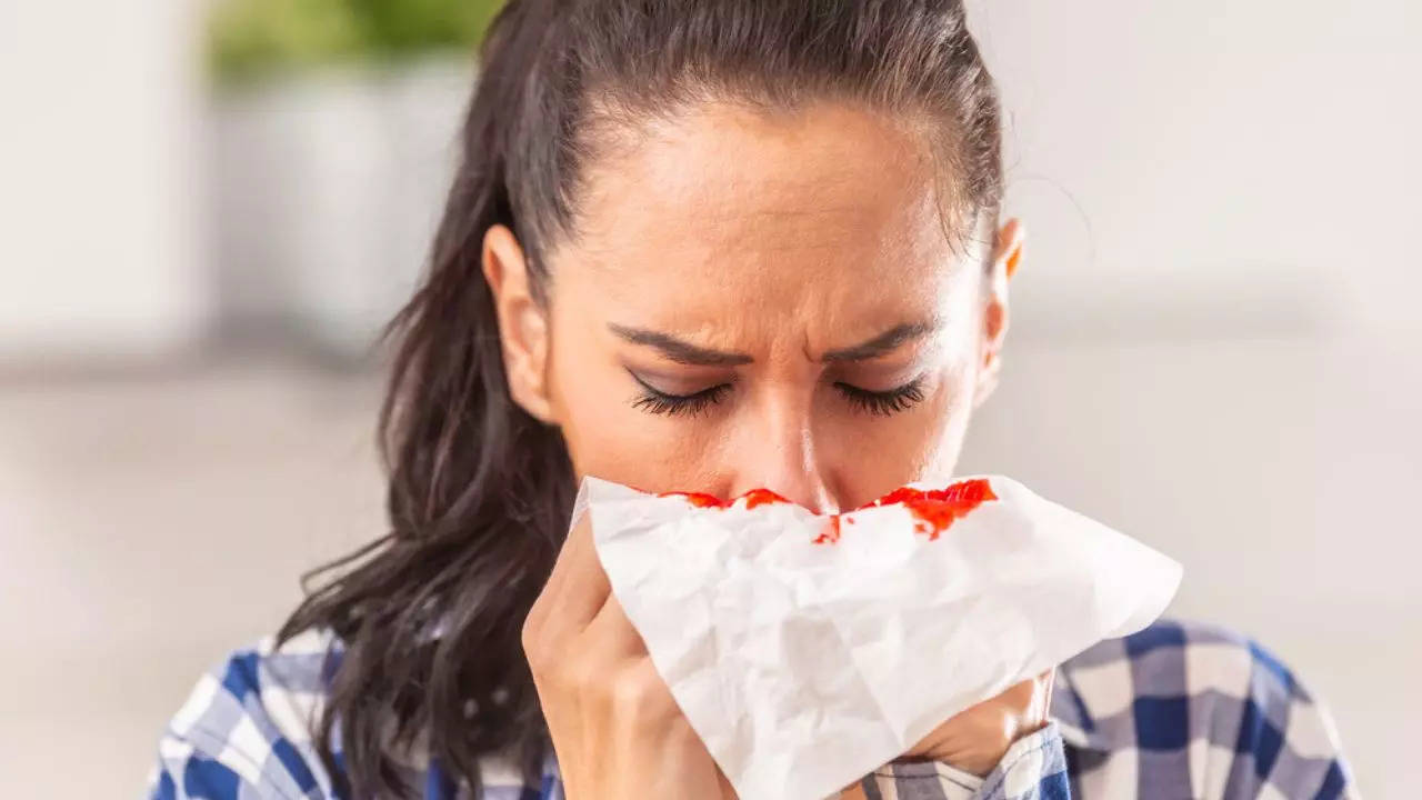 Home Remedies For Nose Bleeding