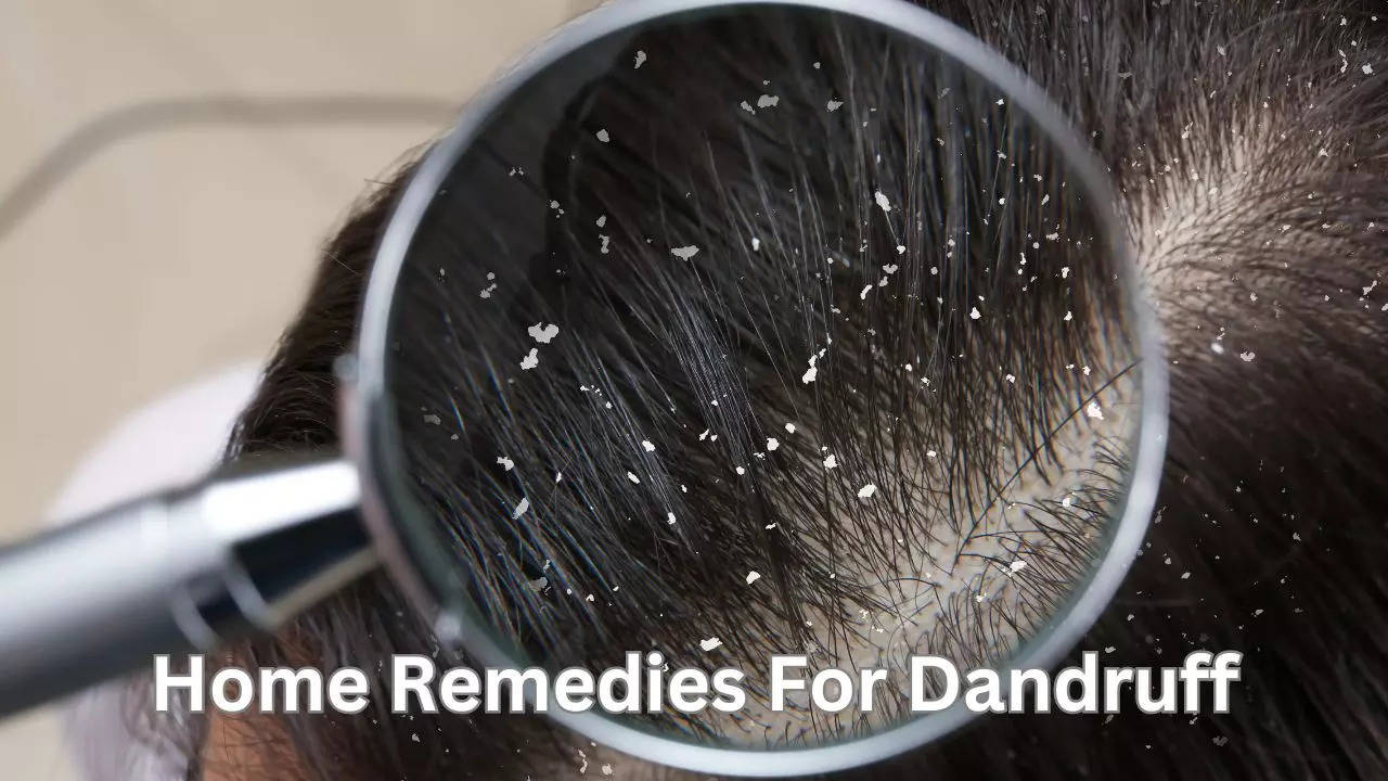 3 Home Remedies For Dandruff And Hair Fall In Hindi