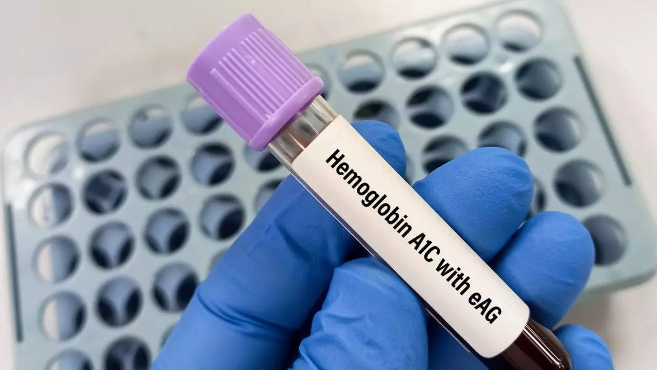 Normal Range of Hemoglobin