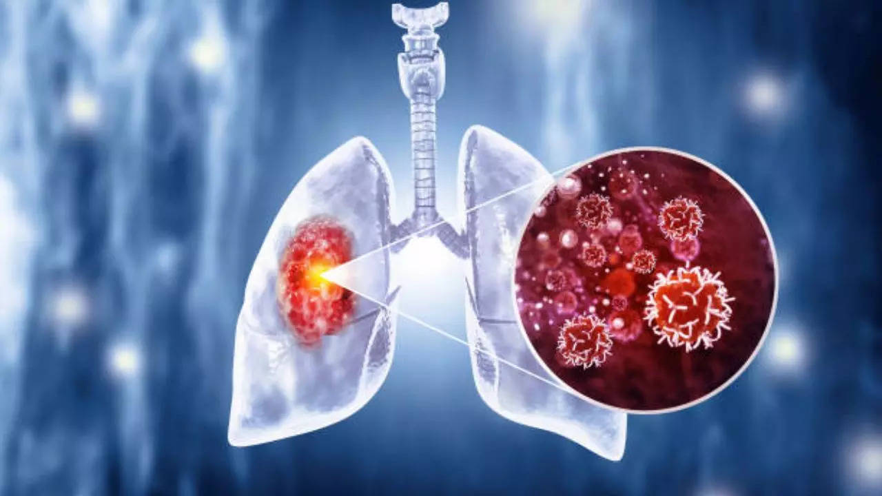 lung cancer symptoms