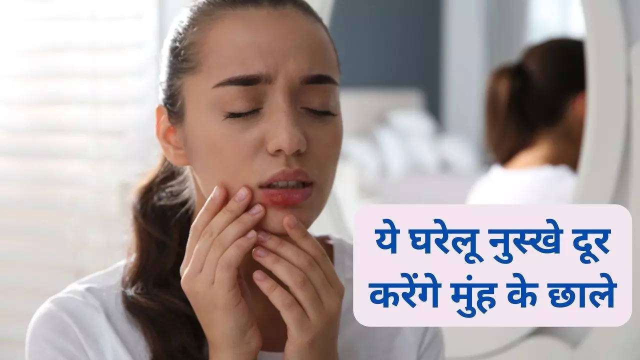 Mouth Ulcers Home Remedies