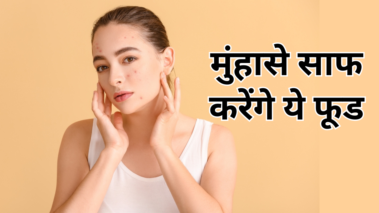 Foods To Clear Acne Pimples In Hindi