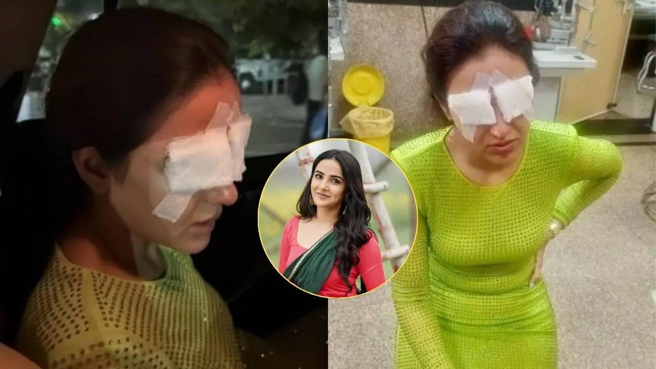 Jasmin Bhasin eyes got damage after wearing lense