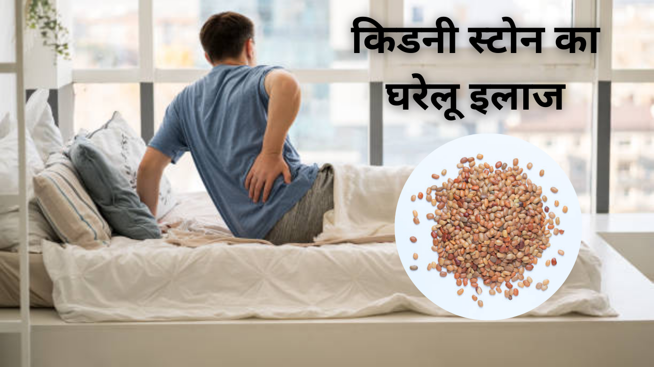 home remedies for kidney stone