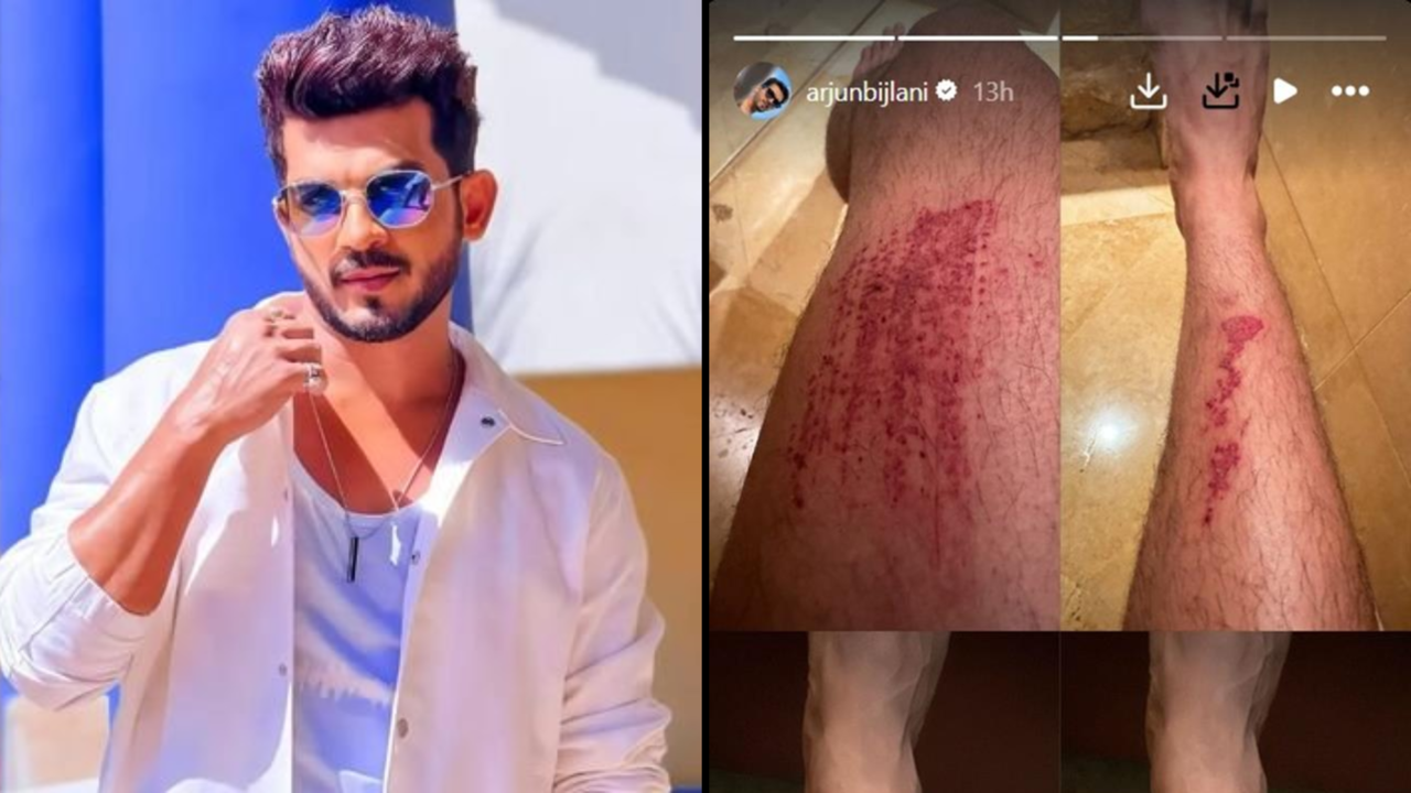 Arjun Bijlani meets with an accident in Goa