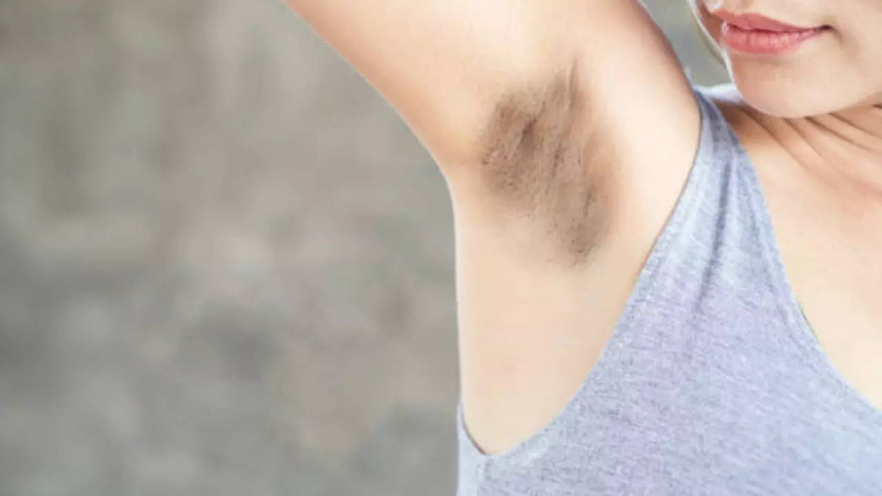 how to get rid of dark underarms