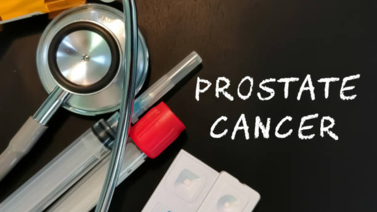 Prostate Cancer Cases