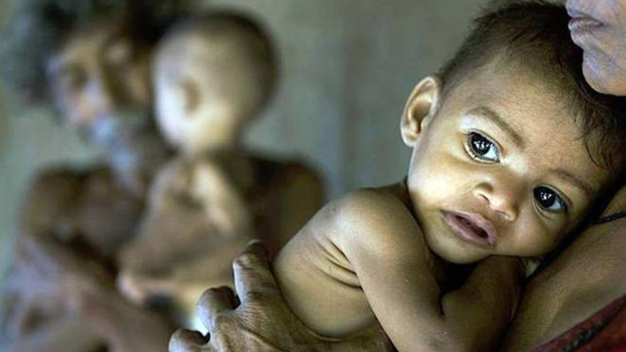 3 crore children found victims of malnutrition know how to fulfill your nutrients value in hindi