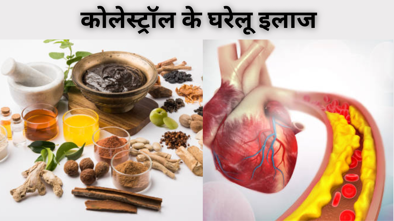 home remedies for cholesterol