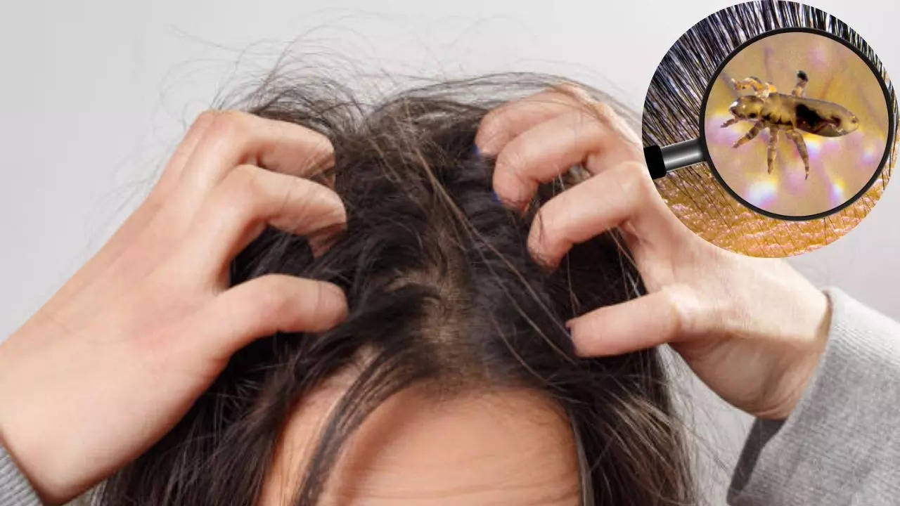 Home Remedies to get rid of lice