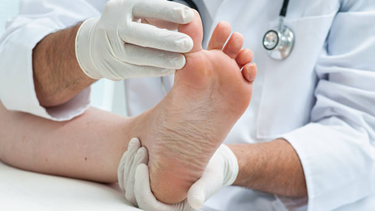 fungal infection in feet