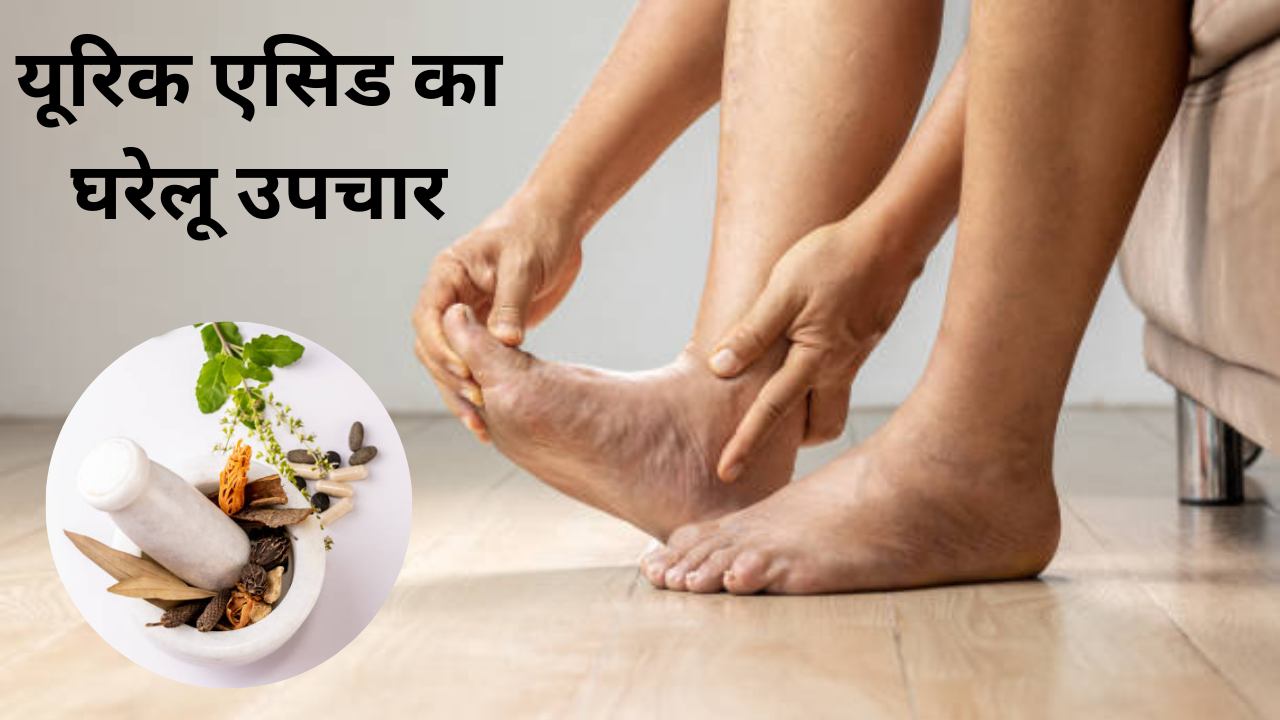 home remedies for uric acid