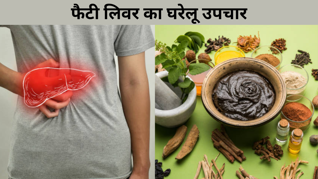 Home remedies for fatty liver