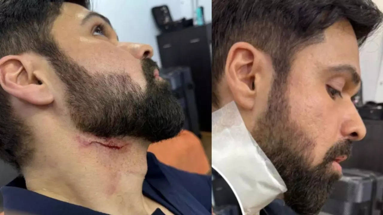 Emraan Hashmi Injured