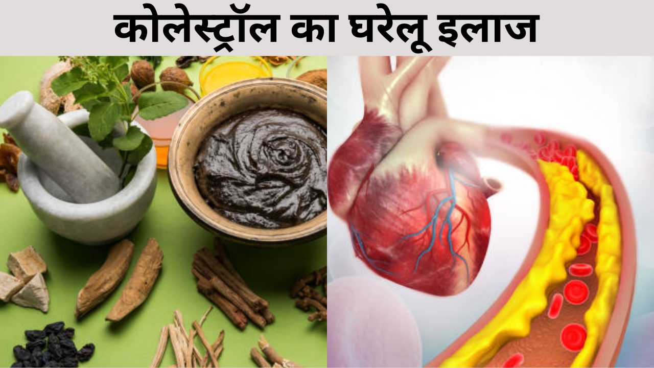 home remedies for cholesterol