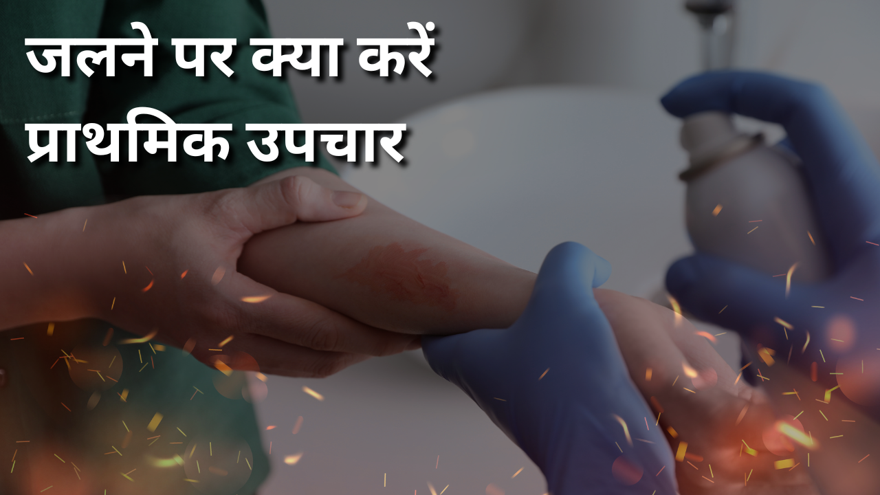 Home Remedies For Burns In HIndi