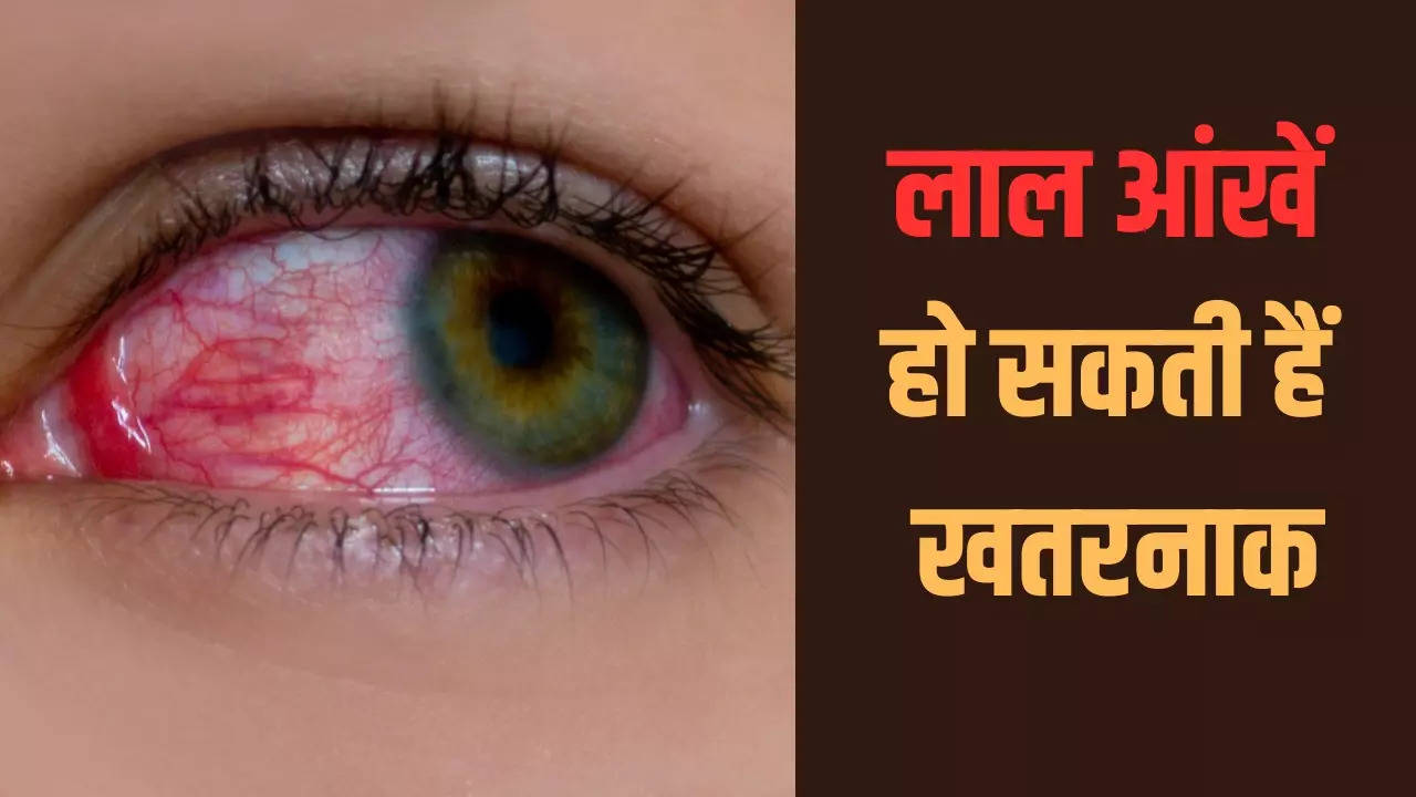 red eyes reason and treatment, red eyes ka ilaj