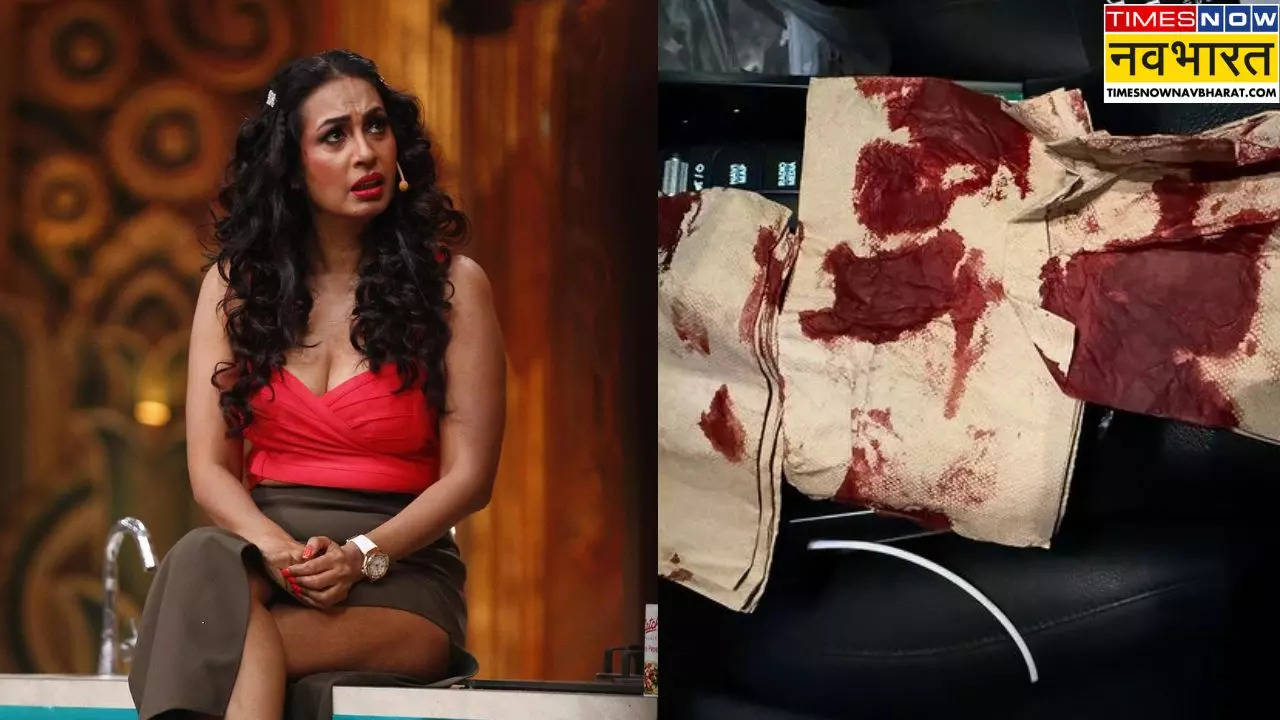 Kashmera Shah Met With Accident