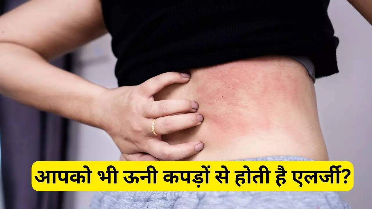 woolen rash home remedies in hindi