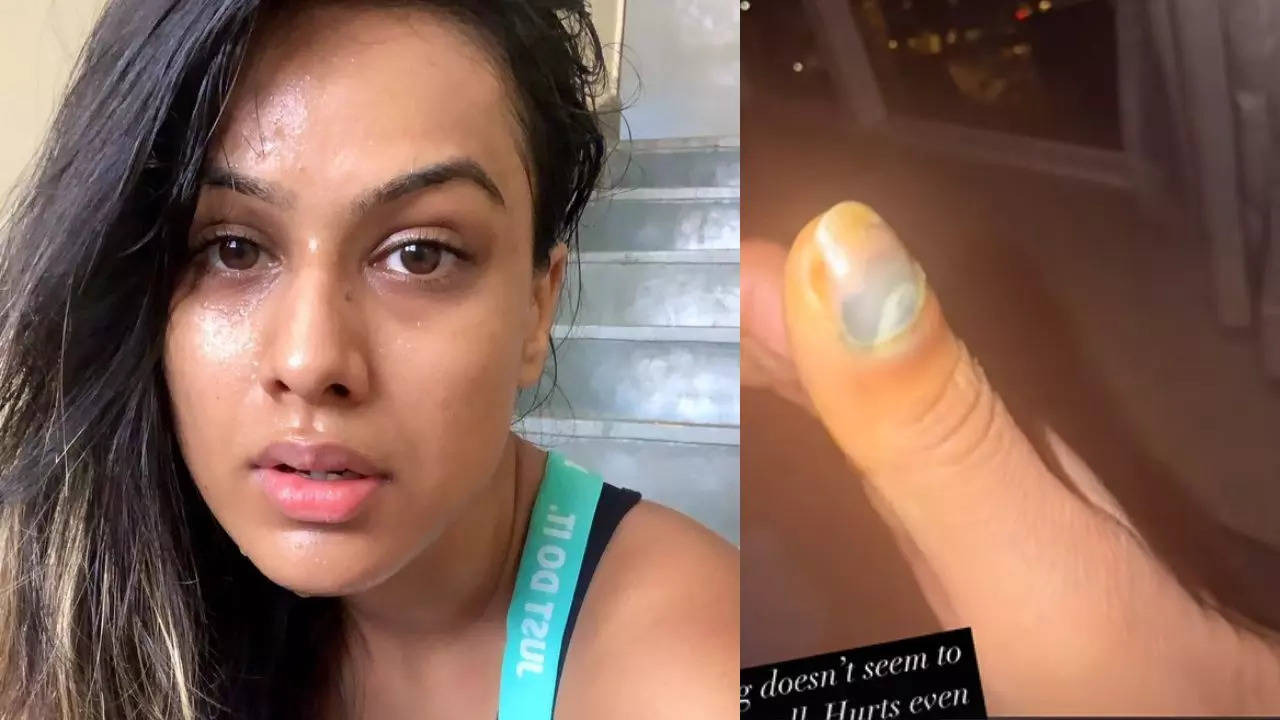 Nia Sharma Taking Five Painkillers in Day