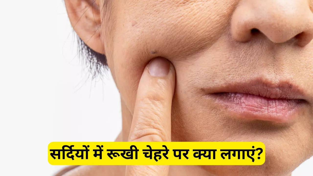 how to treat dry skin in winter at home