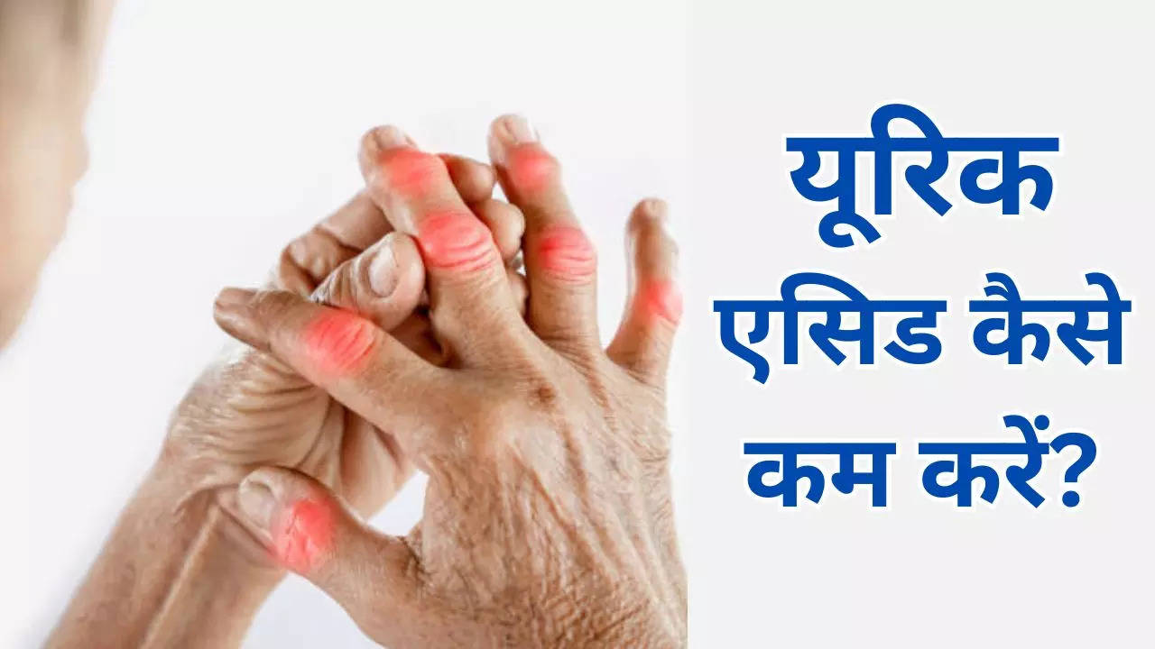 How To Reduce Uric Acid In Hindi