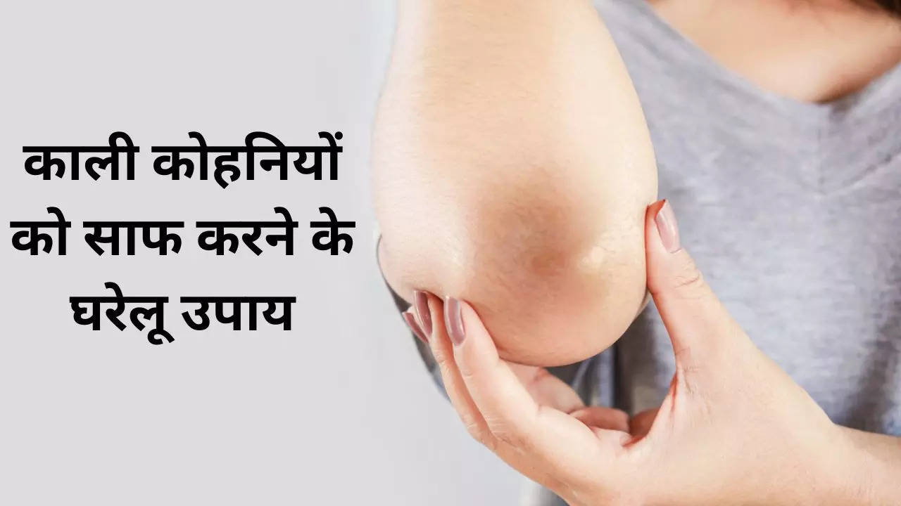 Home Remedies: काली कोहनियों और घुटने को साफ करने के घरेलू उपाय, दही और बेसन के अलावा कारगर हैं चीजें