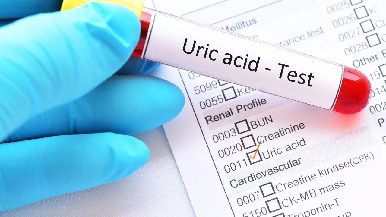 Uric Acid In Women