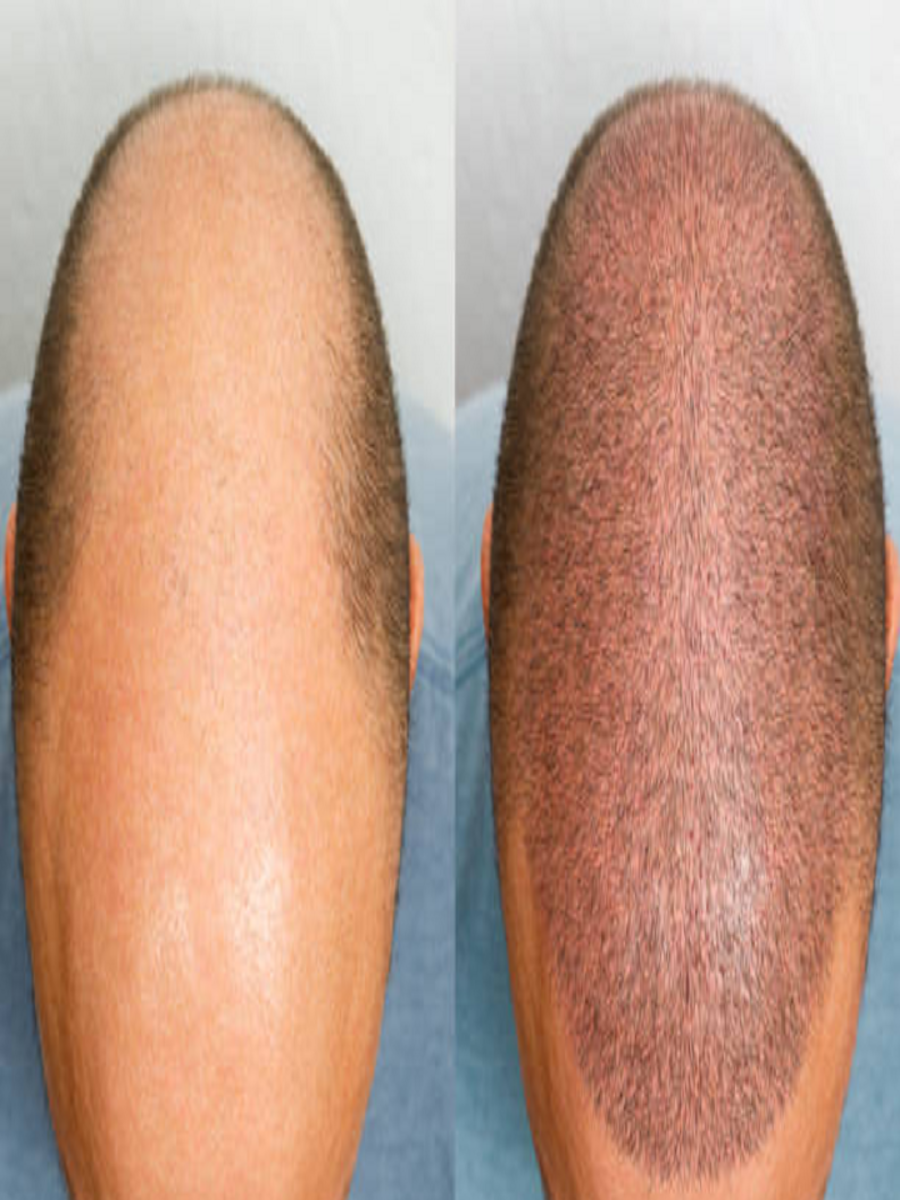 Desi Ghee Benefits Remove baldness, Hair Growth, Regrow Hair, Soft